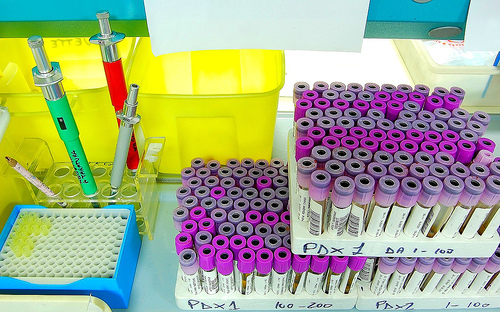 Screening, e poche storie